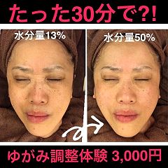 144位のイメージ