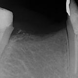 464位のイメージ