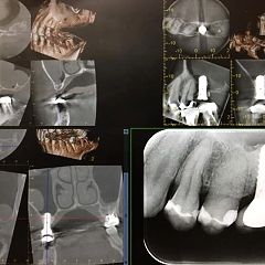 12位のイメージ