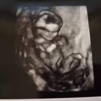 22位のイメージ