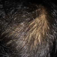 218位のイメージ