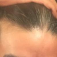 113位のイメージ