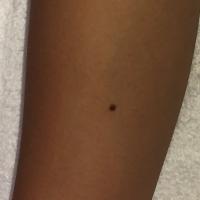 17位のイメージ