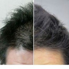 111位のイメージ