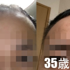 50位のイメージ