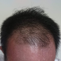 46位のイメージ