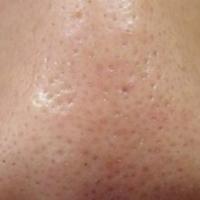 42位のイメージ