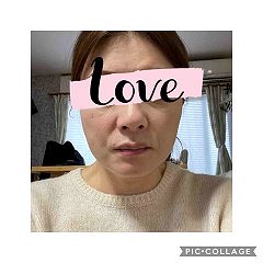 17位のイメージ