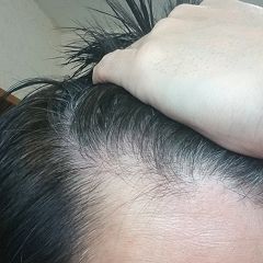 95位のイメージ