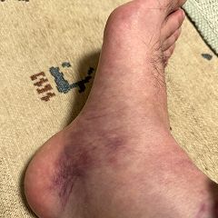 166位のイメージ