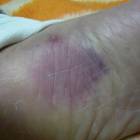 77位のイメージ