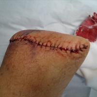 14位のイメージ