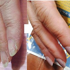 46位のイメージ